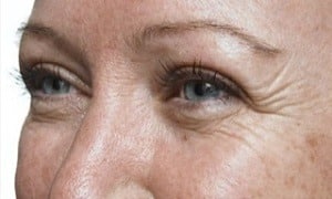 Close-up of a middle-aged person's face showing light skin with freckles. The focus is on the eyes, which have visible wrinkles around them. The eyebrows are thin, and the eyelashes are long. The soft lighting highlights skin texture, challenging middle age perceptions with its gentle realism.