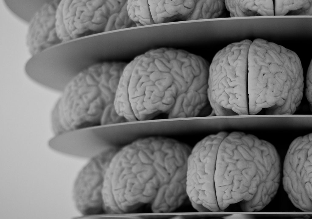 A black and white image depicts Megan Winkler's innovative Neurosculpting® brain models stacked on shelves. The models, showcasing detailed neural patterns, are closely packed in a repetitive arrangement, illustrating the intricate artistry involved.