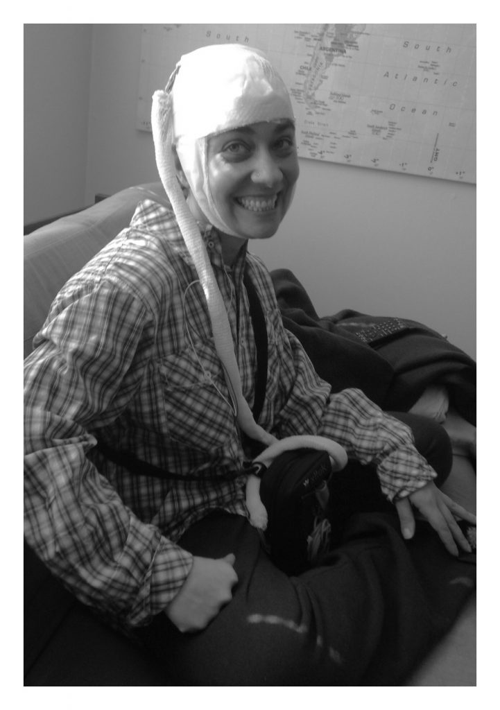 A person sits on a couch, smiling at the camera in a plaid shirt and white head wrap with straps, radiating positivity. A map hangs on the wall behind them—a subtle reminder of their journey to heal. The black-and-white image captures the essence of resilience amidst life's challenges.
